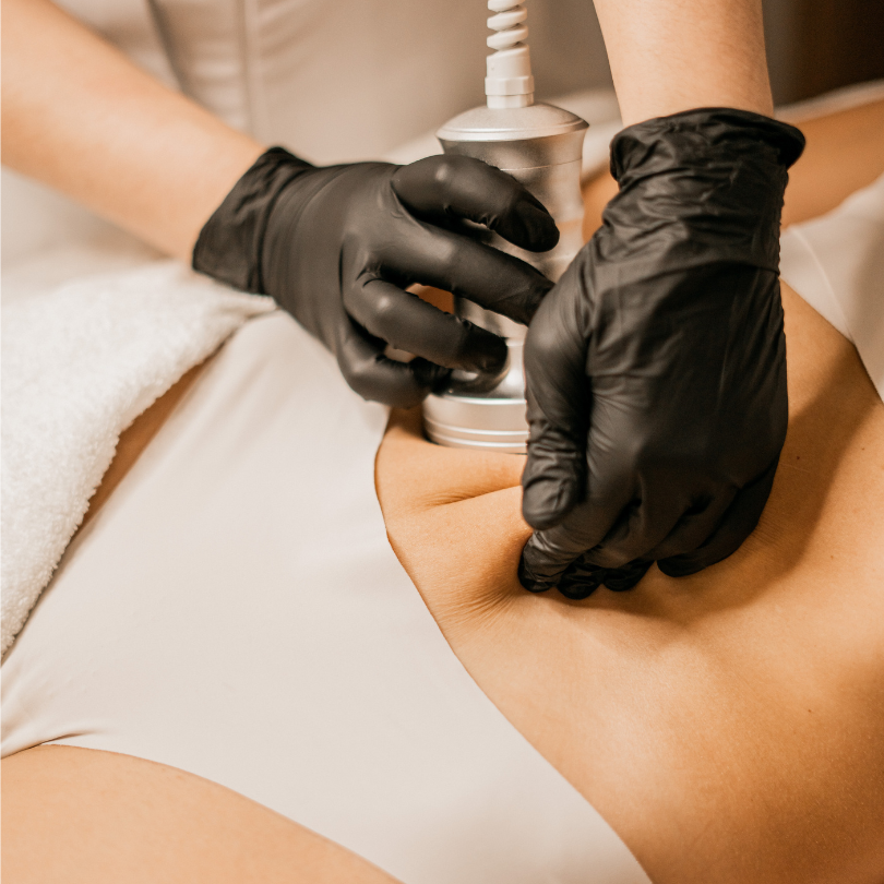 Lipocavitation