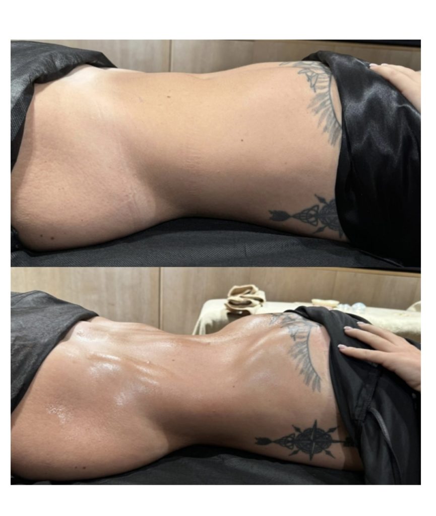 Lymphosculpt bordeaux ana gia